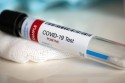 Kalwaria Zebrzydowska wprowadza darmowe testy antygenowe na koronawirusa