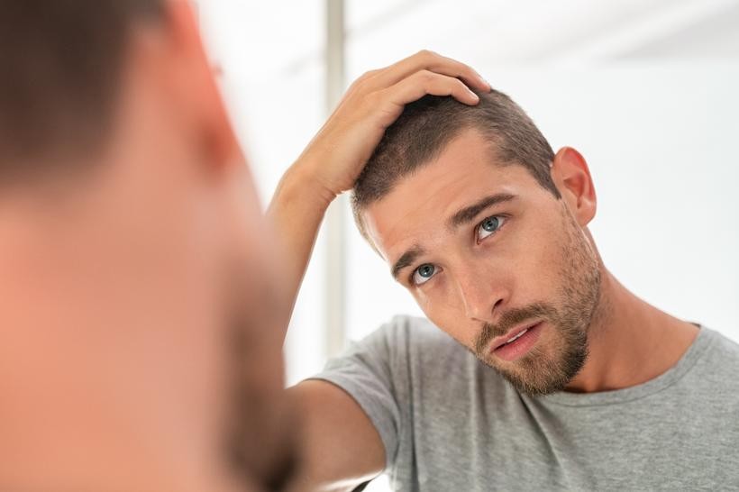 Leczenie łysienia – dlaczego włosy zaczynają wypadać? Poznaj powody i dostępne rozwiązania